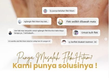 cara menghilangkan flek hitam