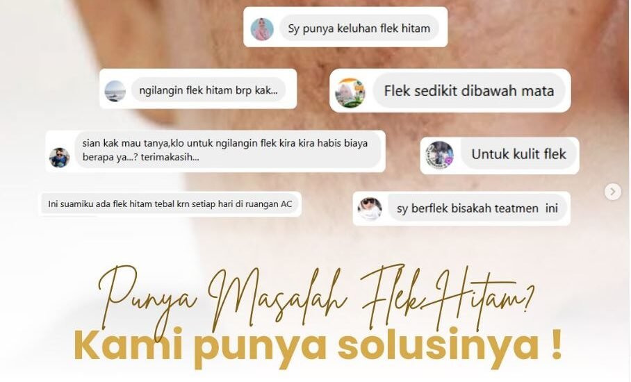 cara menghilangkan flek hitam