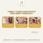 threadlift