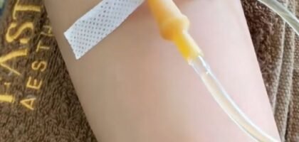 infus whitening jember